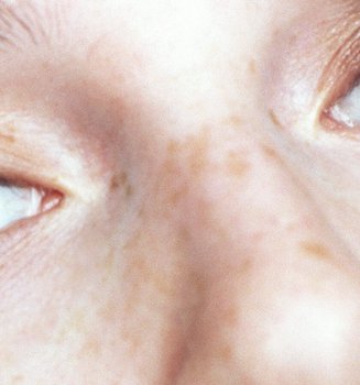 Eye Contour Acupressure The Solution For Younger Looking Eyes Hero