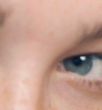 Our Tips To Get Rid Of Eye Bags